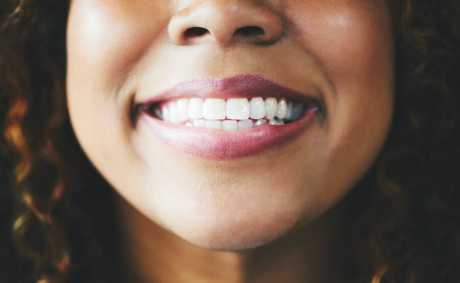 Closeup of a Black woman smiling after professional teeth whitening in Hermitage, TN