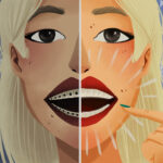 graphic of woman comparing traditional braces with invisalign process