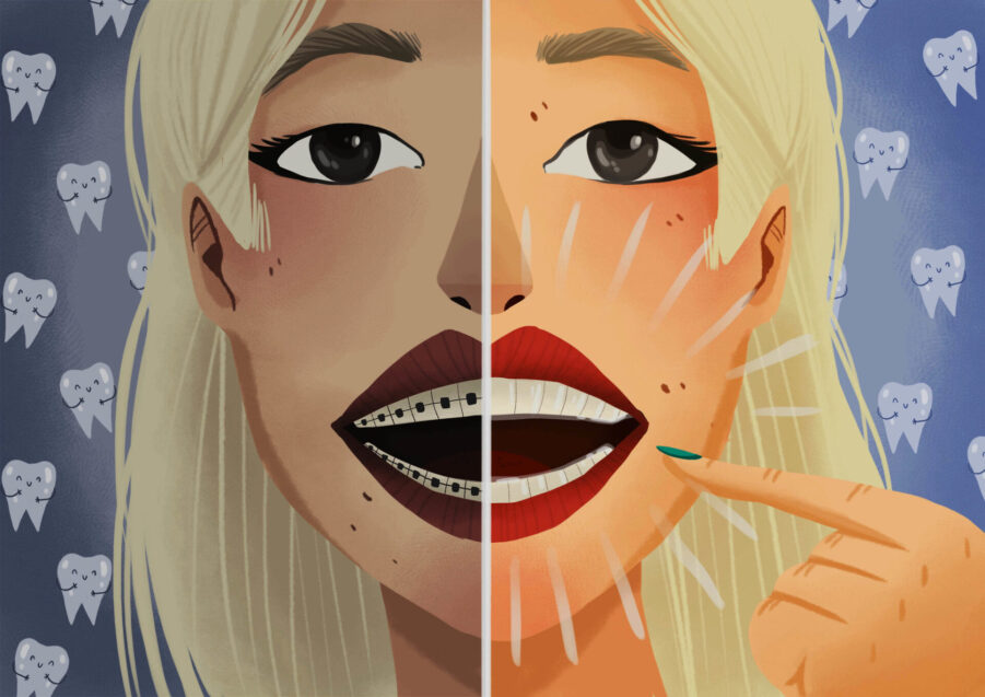 graphic of woman comparing traditional braces with invisalign process