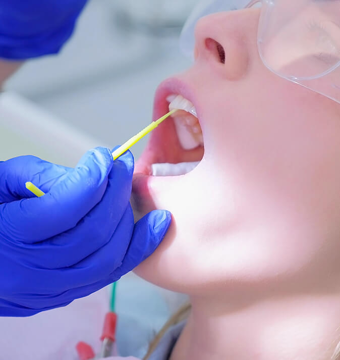 dental patient receiving a fluoride treatment