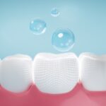 professional fluoride treatment on tooth