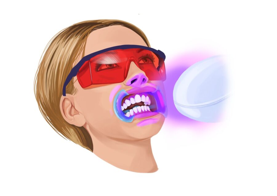 woman getting teeth whitening before dental veneers